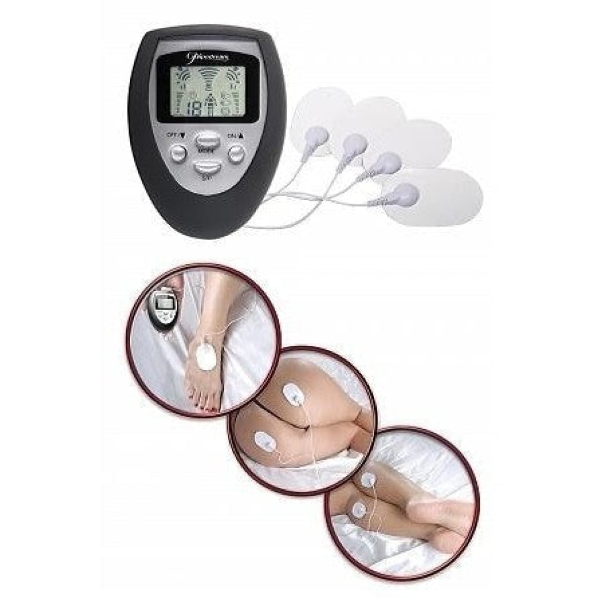 Fetish Fantasy Shock Therapy - Electric Stimulation for Fetish Play Intimates Adult Boutique